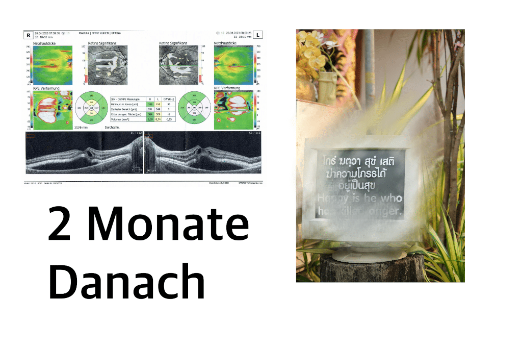 Grafiken und Bild mit verminderter Sicht